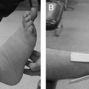 Orthopaedic management
