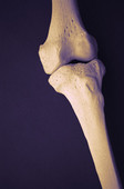 HealthDay news image HealthDay news image