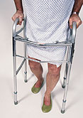 HealthDay news image HealthDay news image