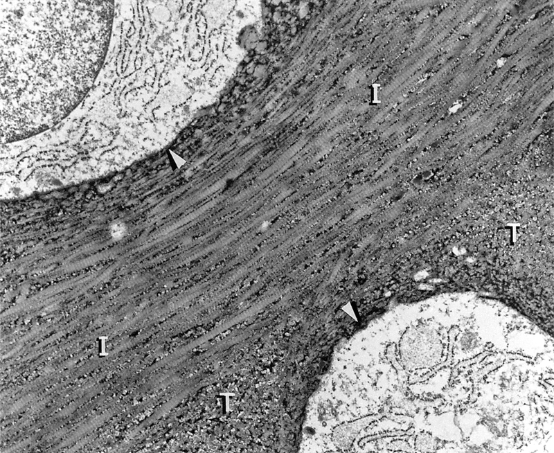 Articular Cartilage