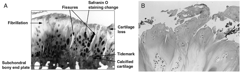 Articular Cartilage