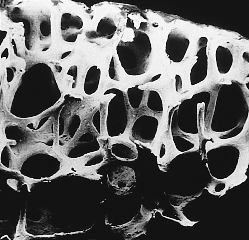 Bone