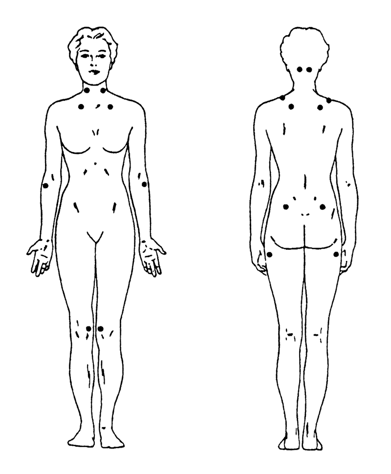 Chronic Pain Syndromes