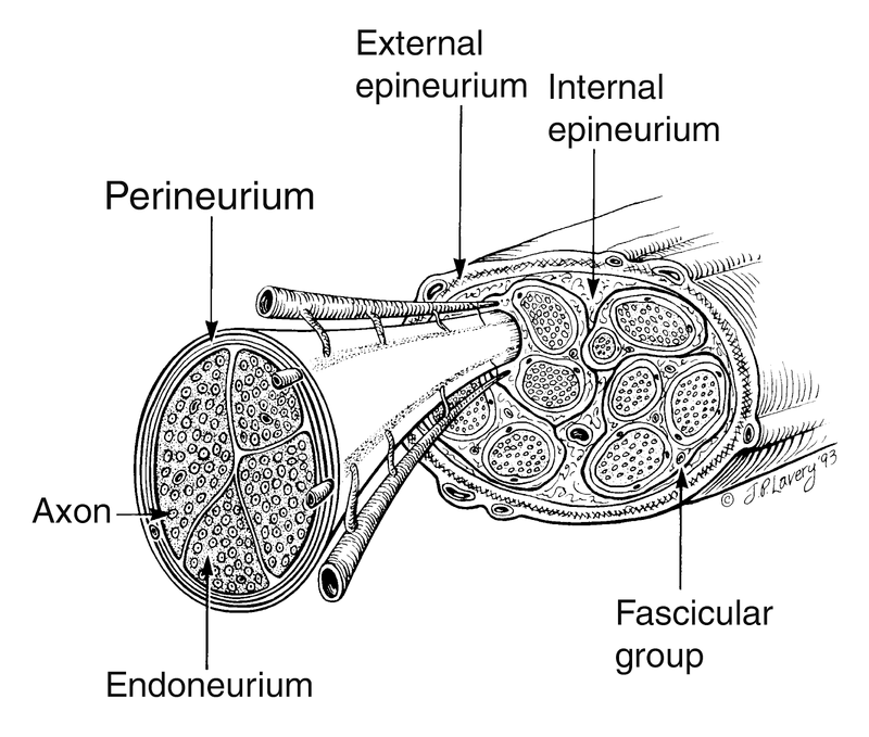 Compression Neuropathies