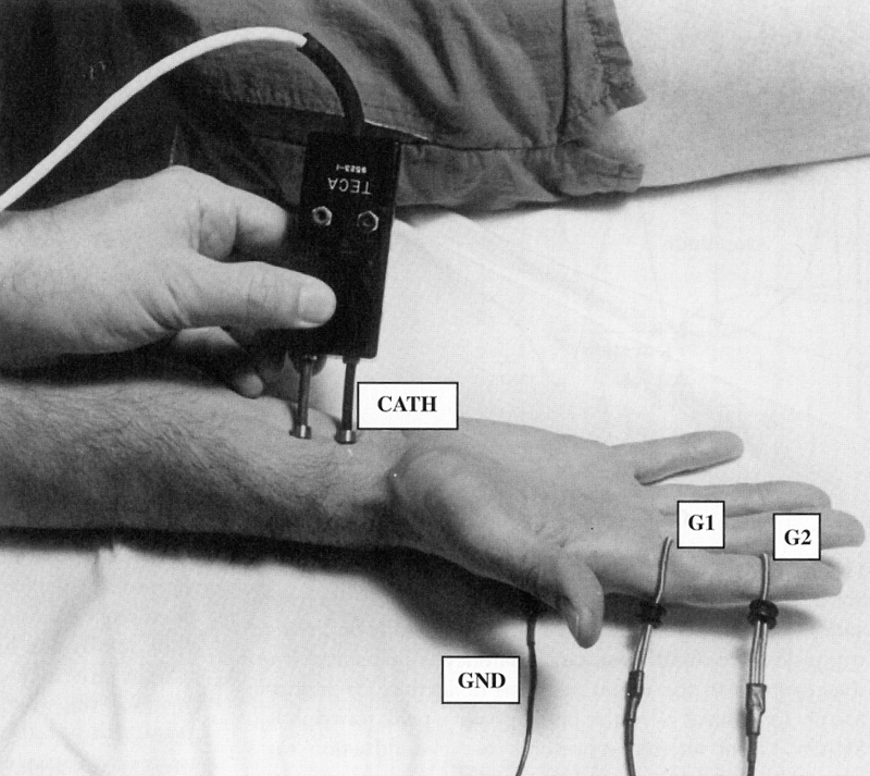 Electrodiagnostic Studies