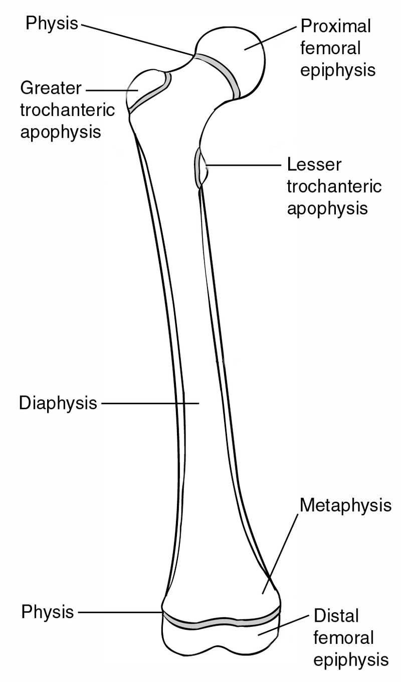 Fracture