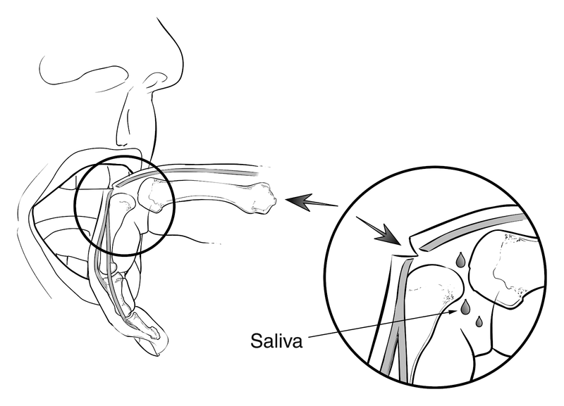 Musculoskeletal Emergencies