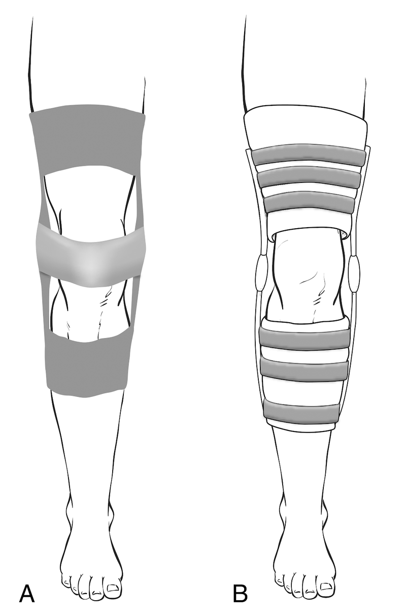 Nonsurgical Therapy