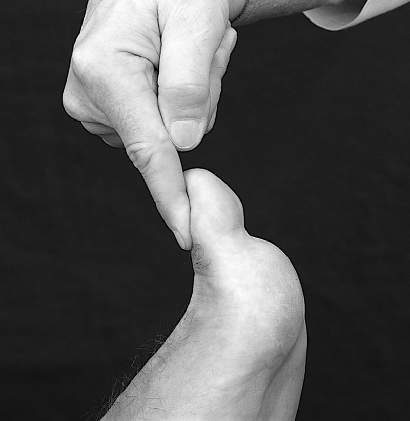 Physical Examination