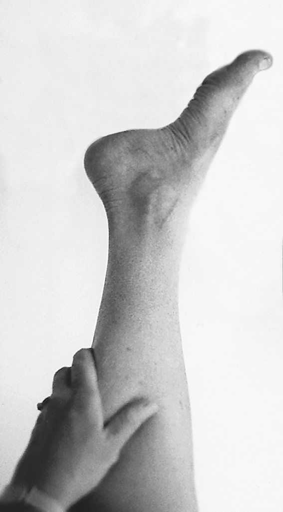 Physical Examination