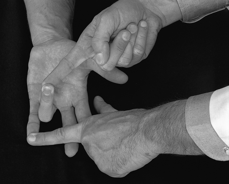 Physical Examination