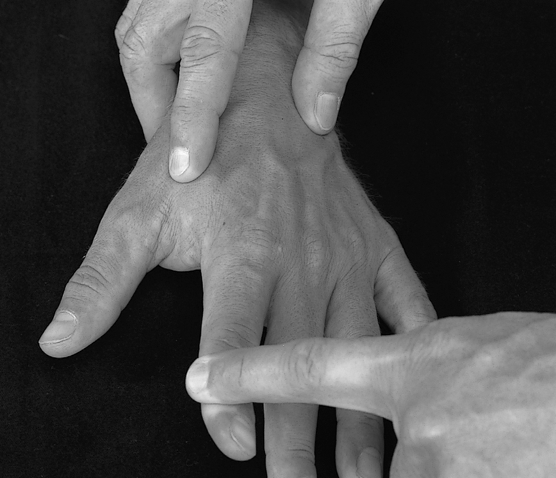 Physical Examination