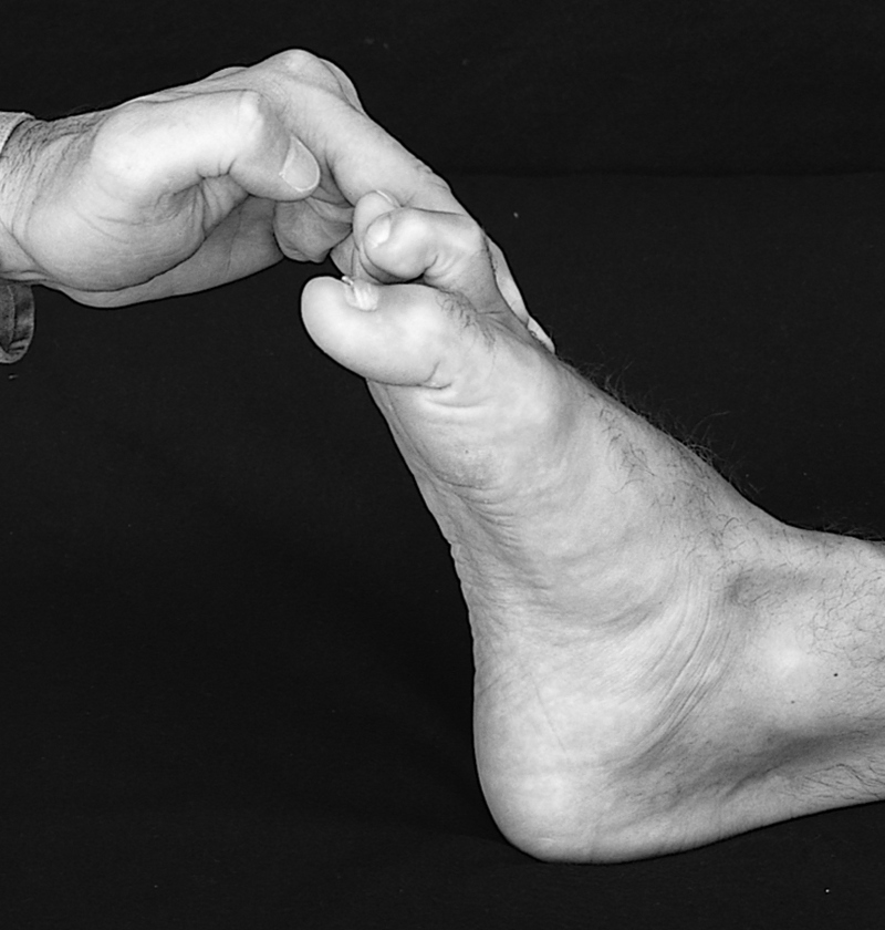 Physical Examination