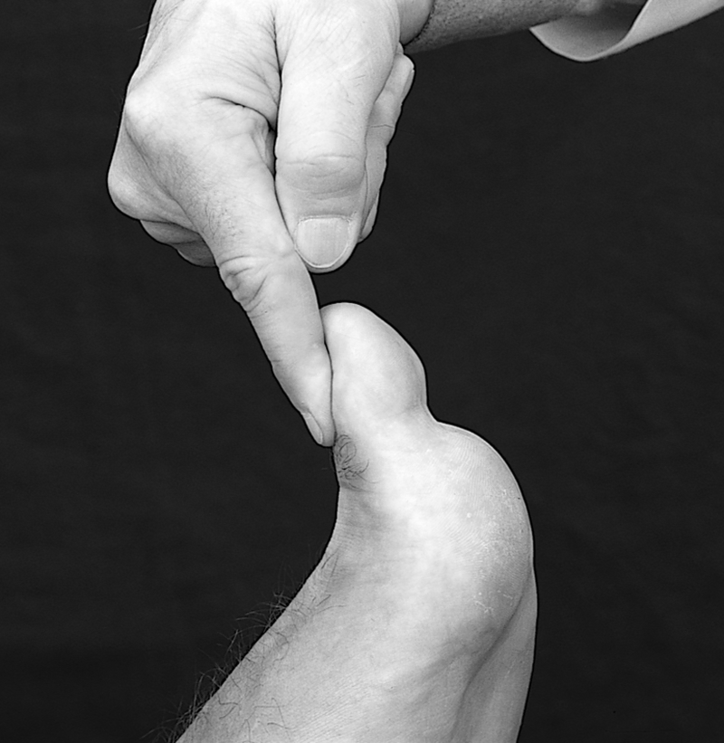 Physical Examination