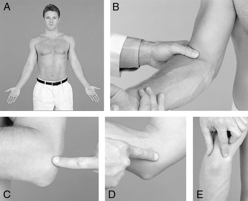 Physical Examination