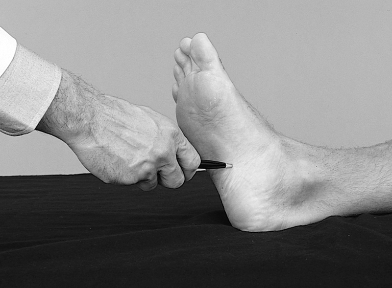 Physical Examination