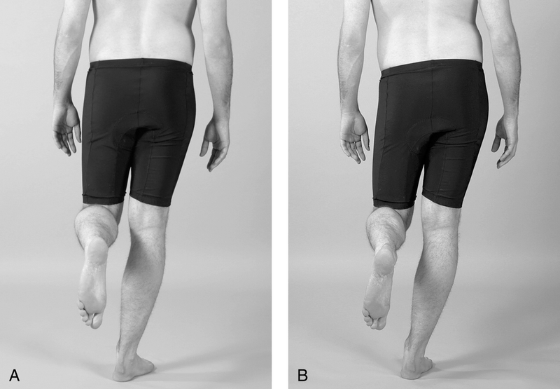 Physical Examination