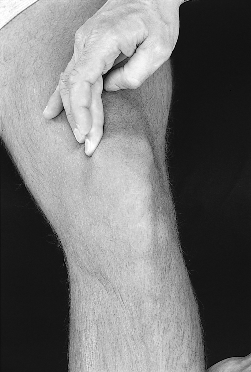 Physical Examination