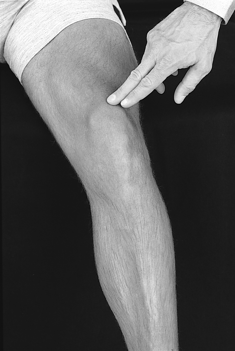 Physical Examination