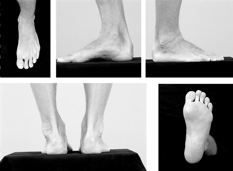 Physical Examination