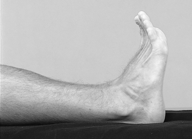 Physical Examination