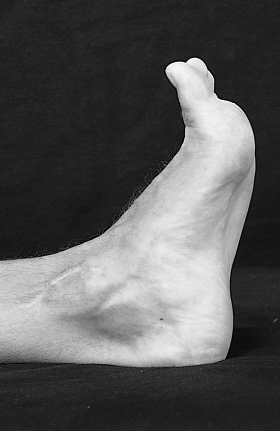 Physical Examination
