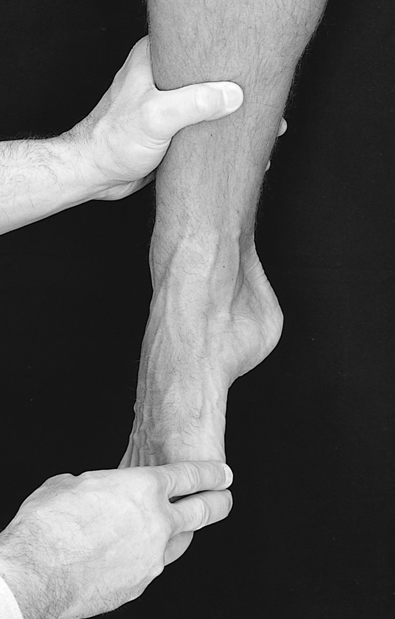 Physical Examination