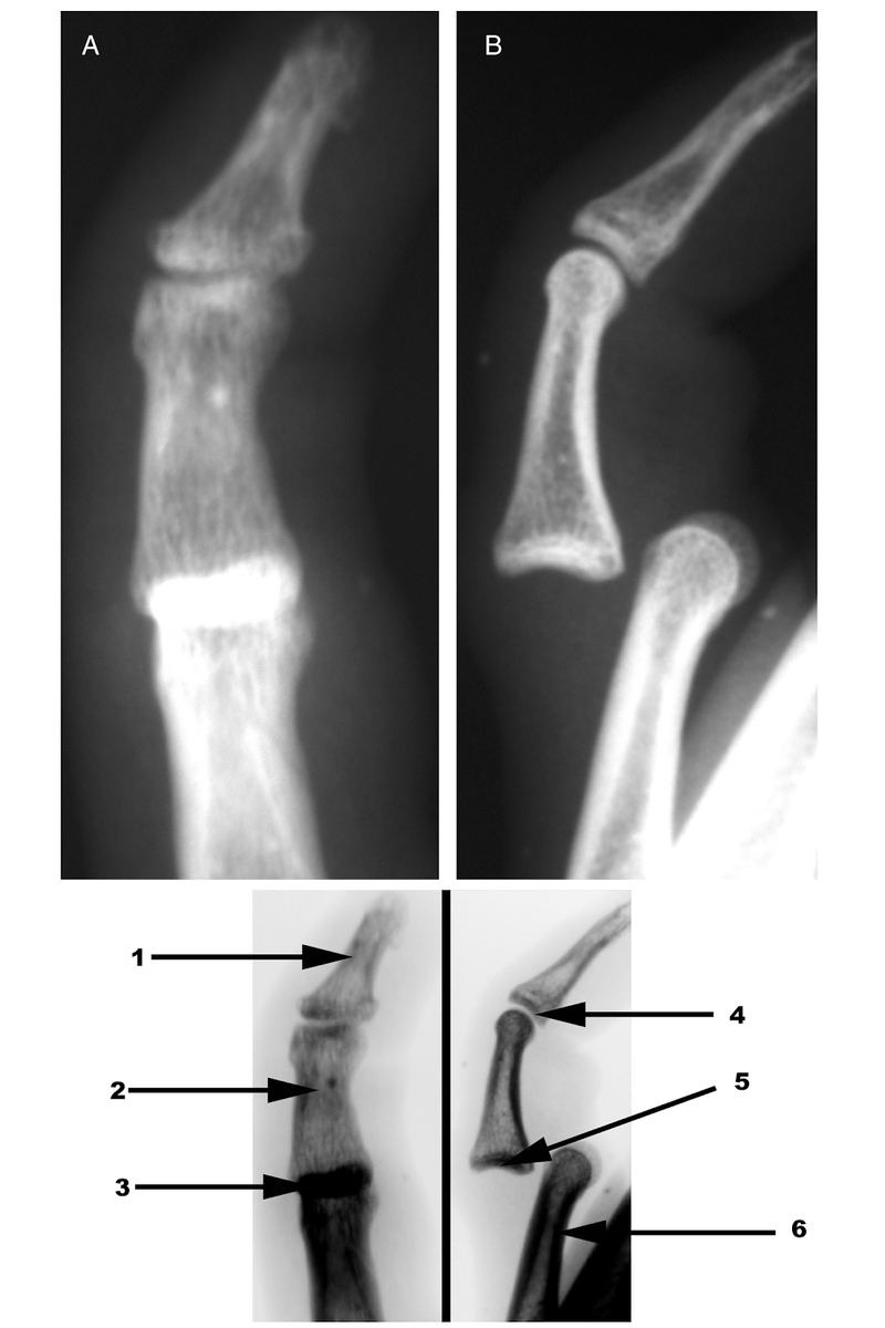 Radiography