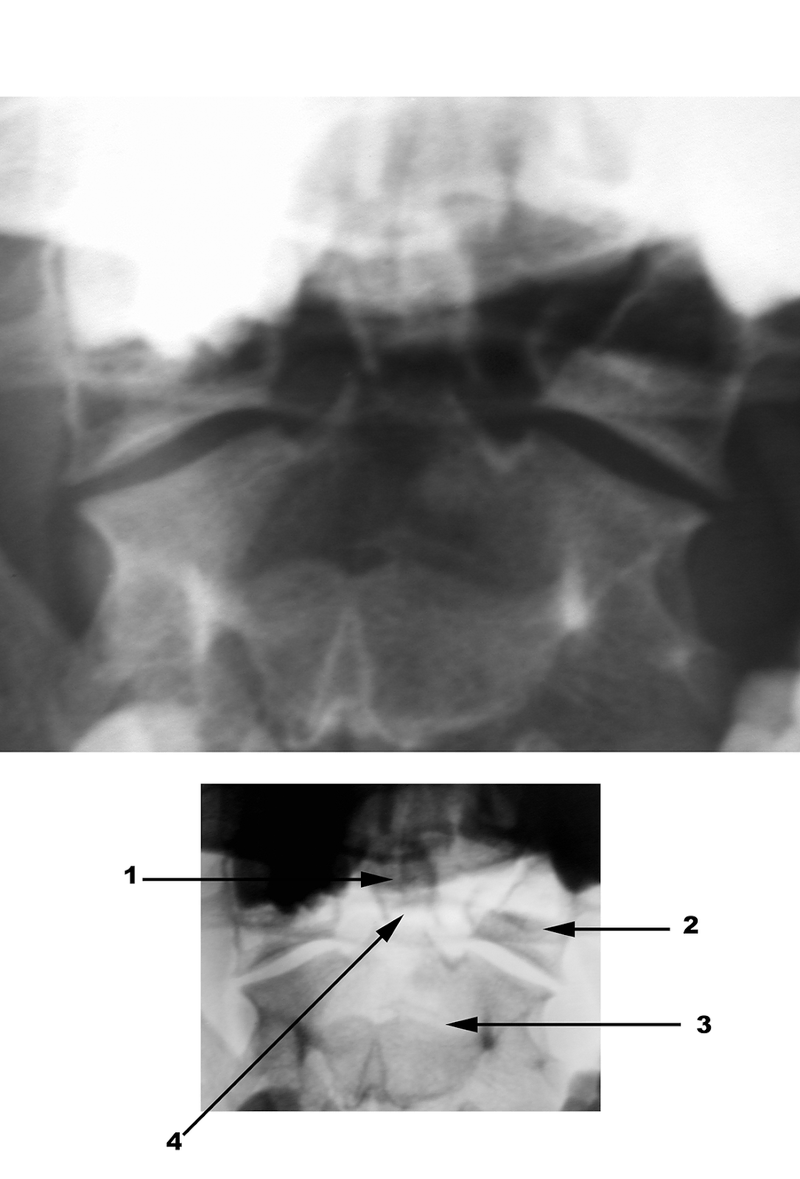 Radiography