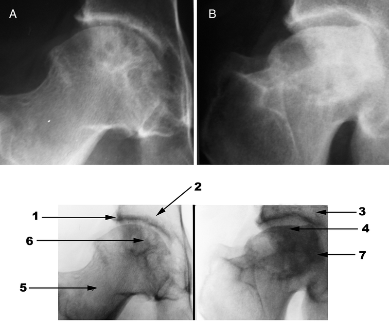 Radiography