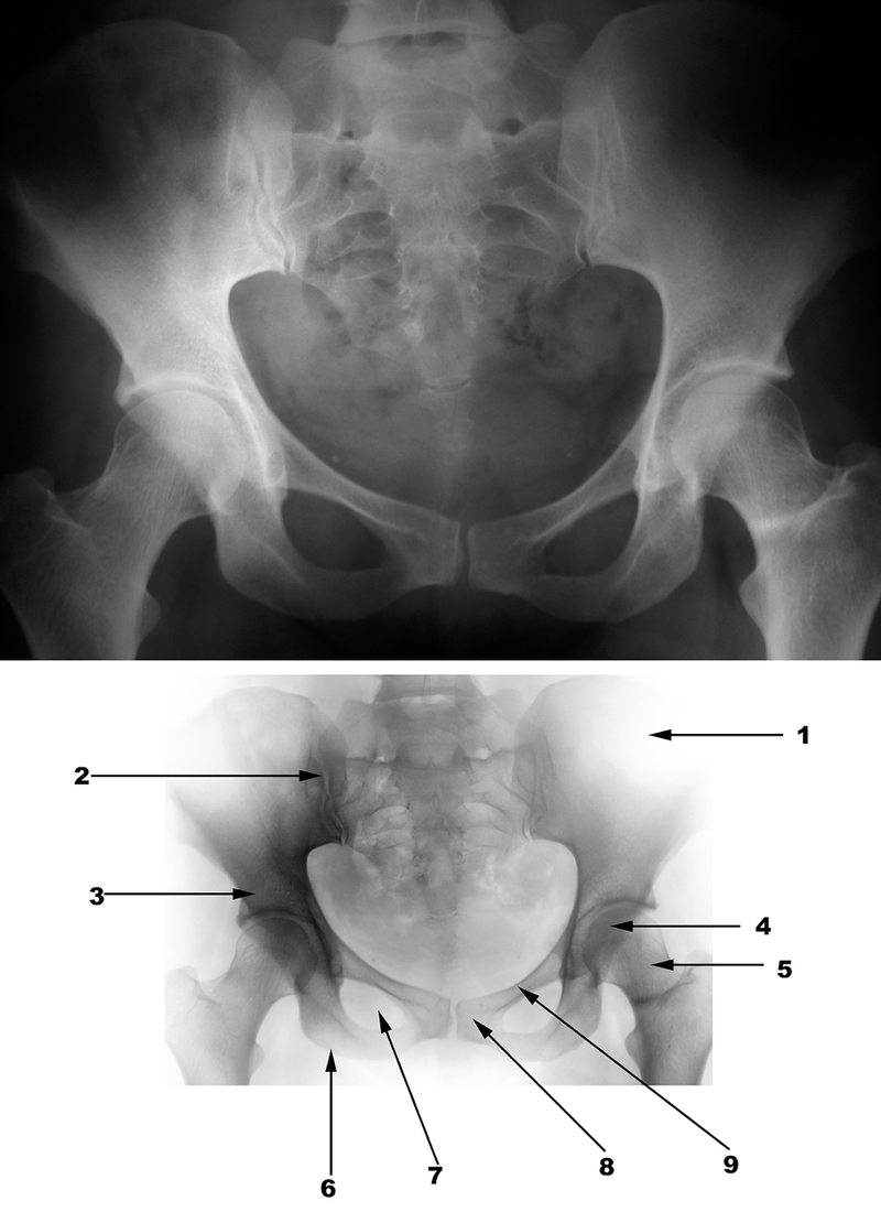 Radiography