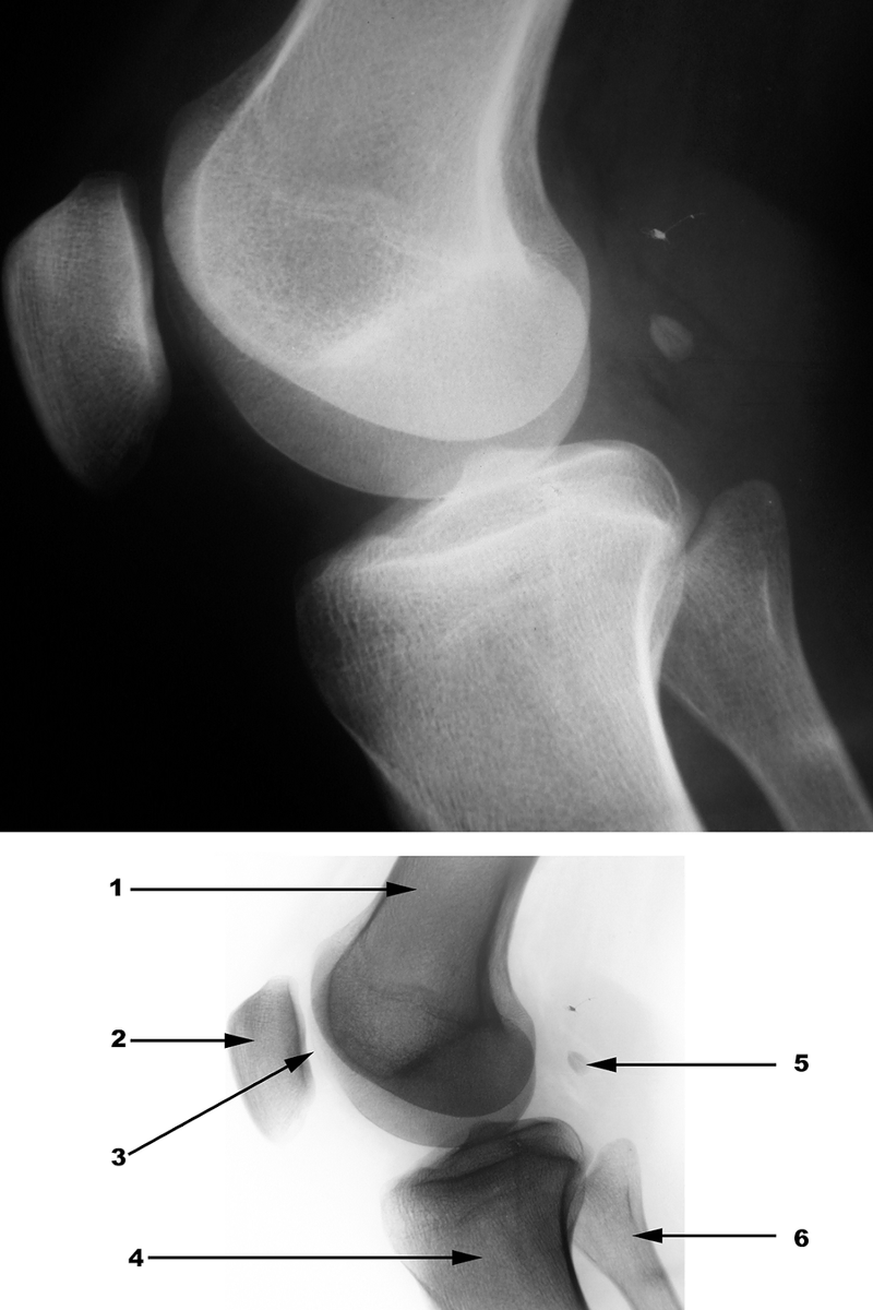 Radiography