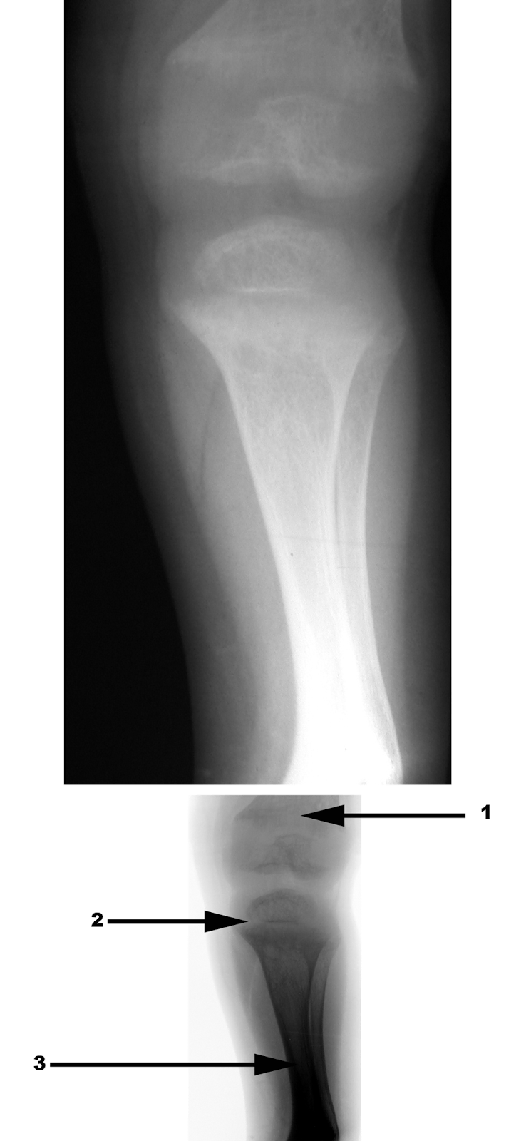 Radiography