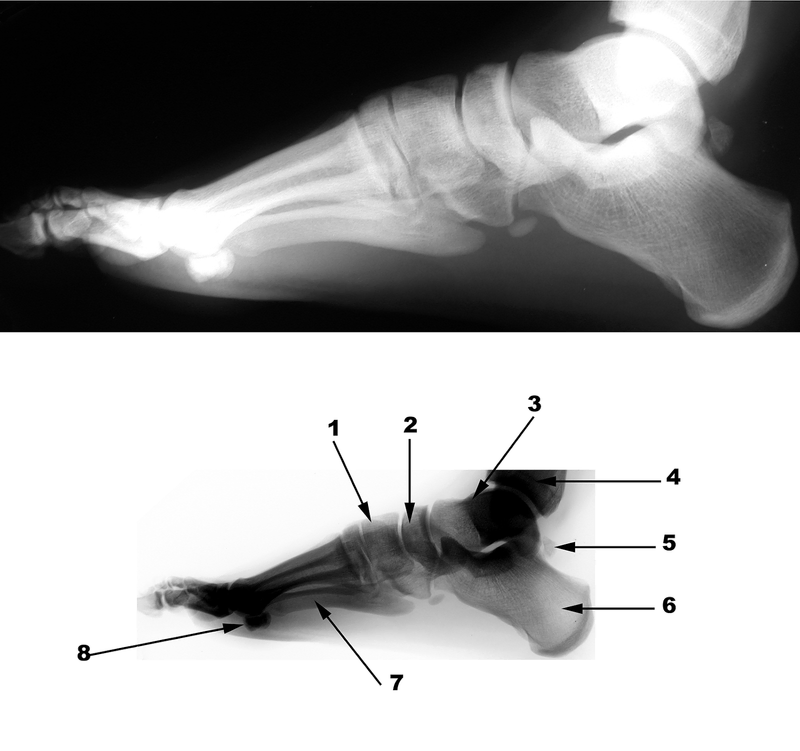 Radiography