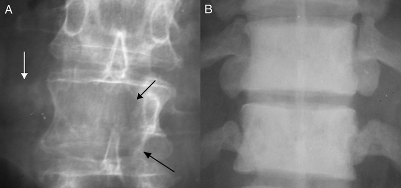 Radiography