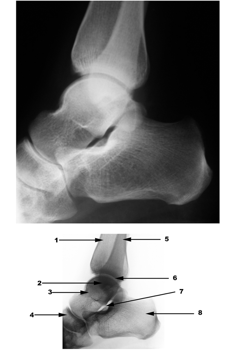 Radiography