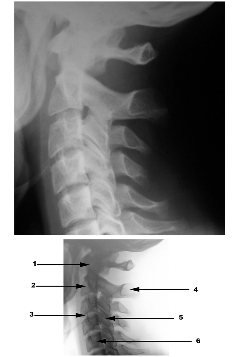 Radiography