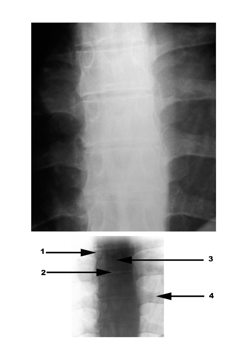Radiography