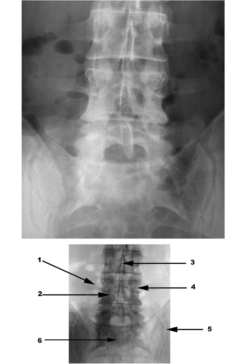 Radiography