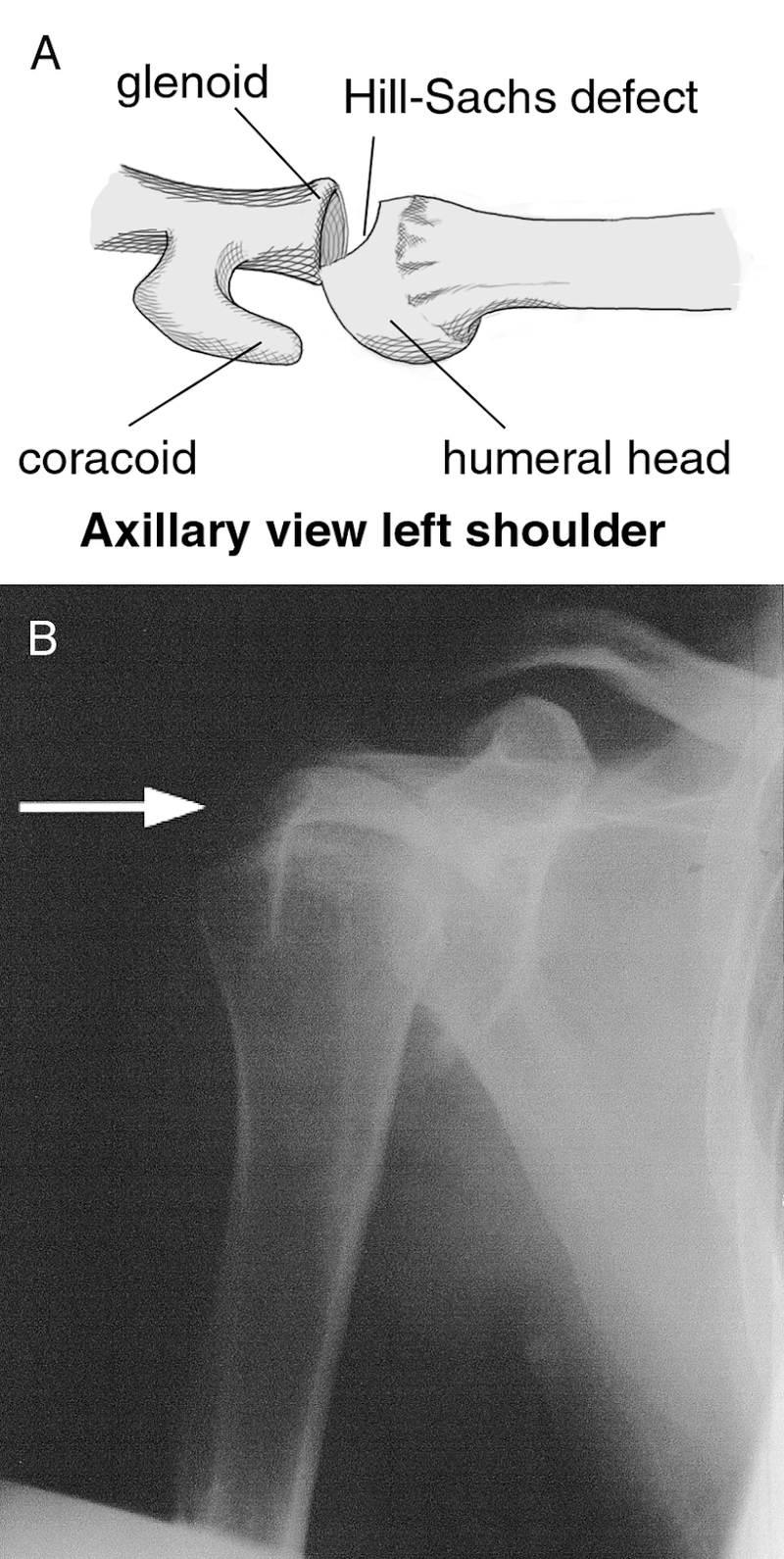 Soft-Tissue Trauma