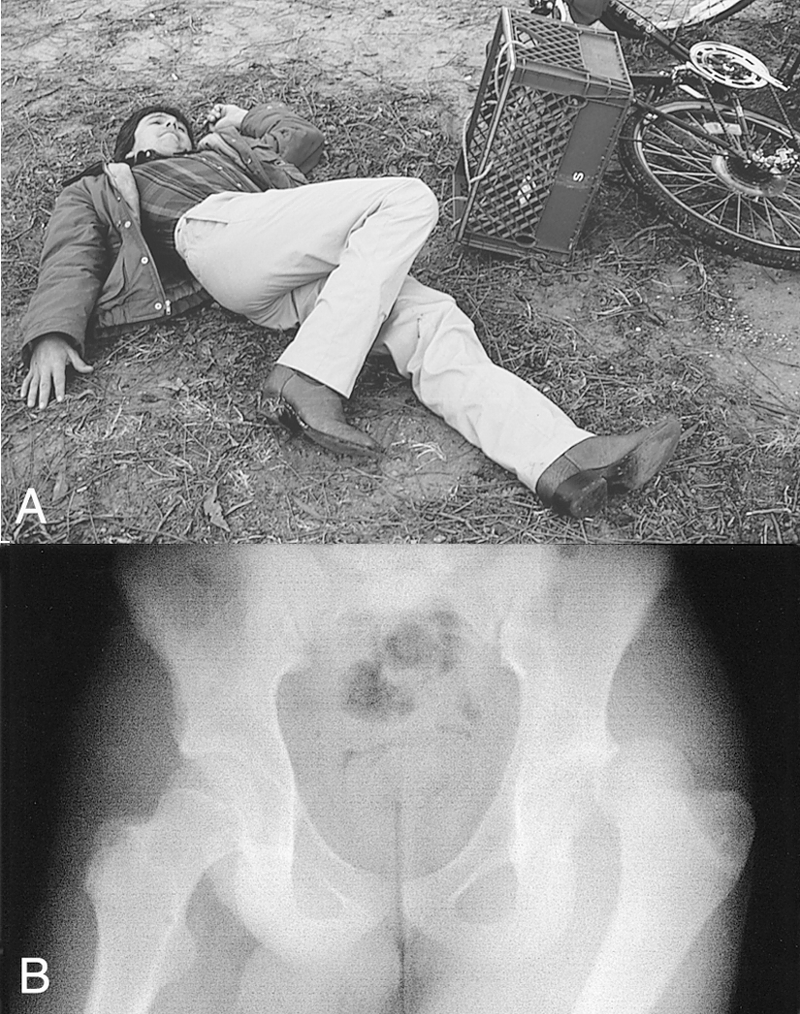Soft-Tissue Trauma