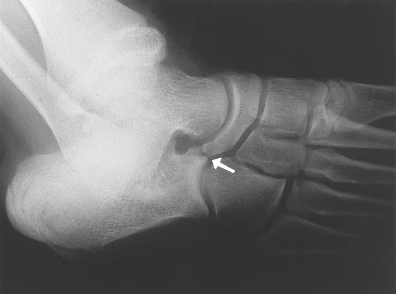 Special Concerns of the Athlete