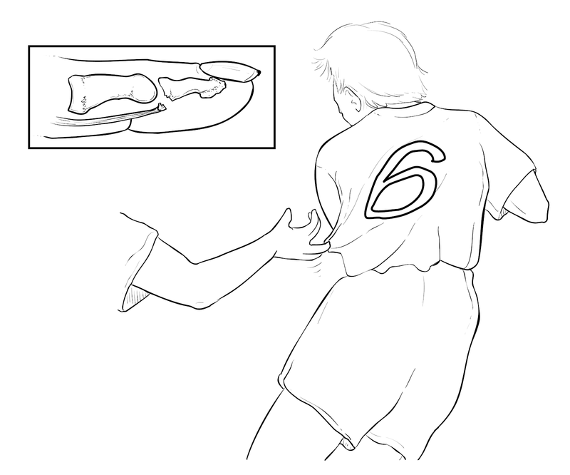 Special Concerns of the Athlete