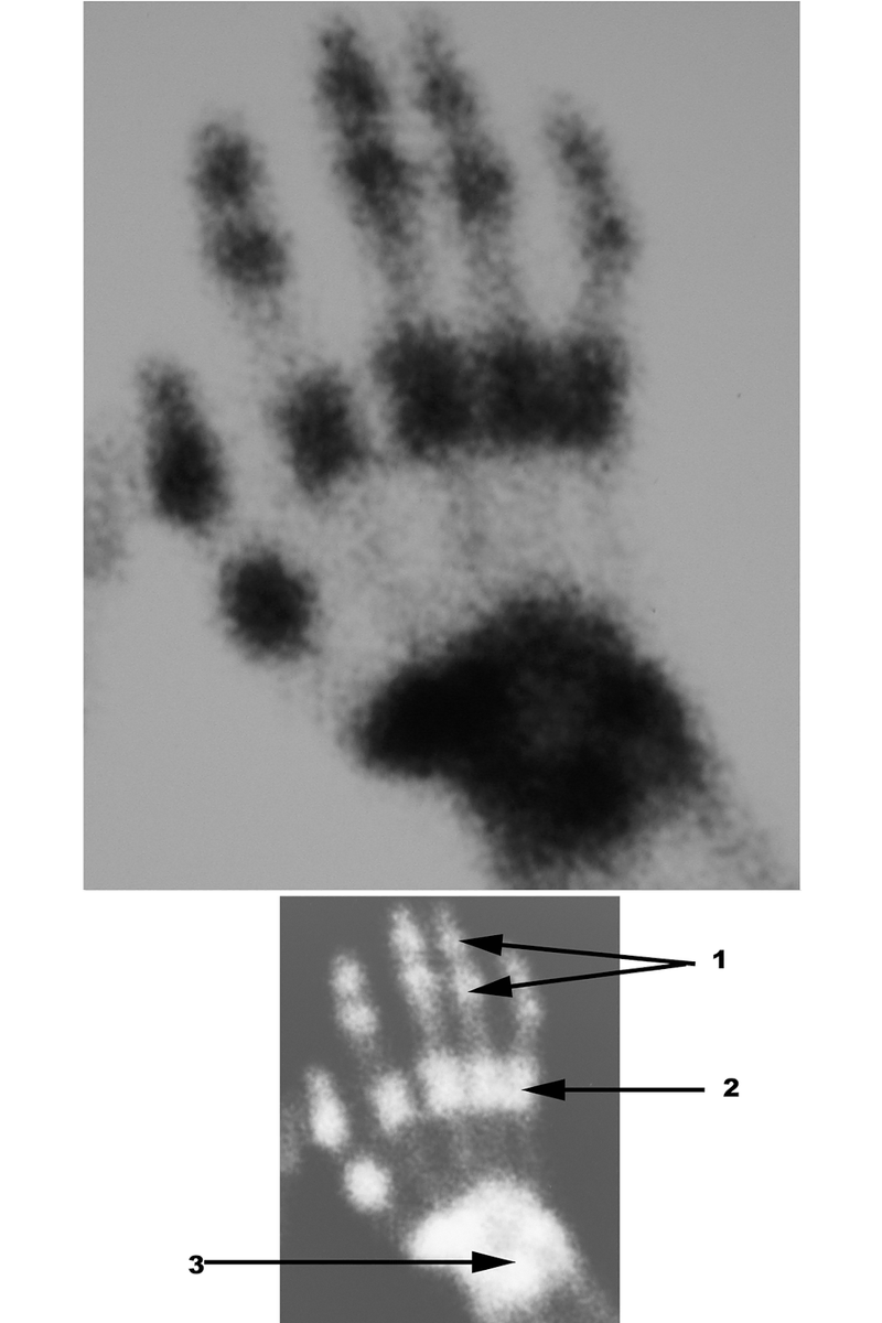Special Imaging Studies