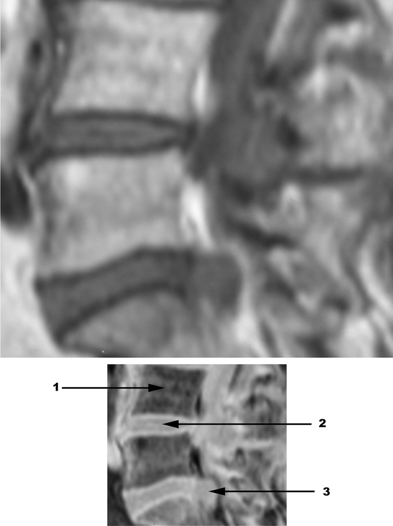 Special Imaging Studies