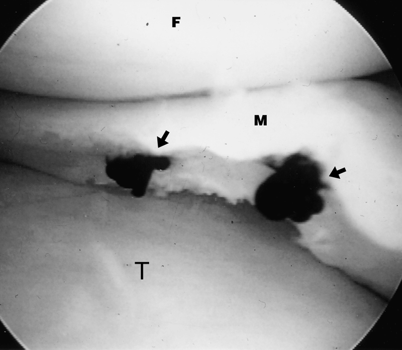 Surgical Treatments