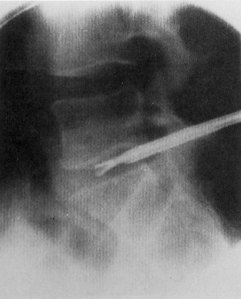 Surgical Treatments