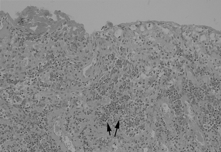 Synovial Tissue