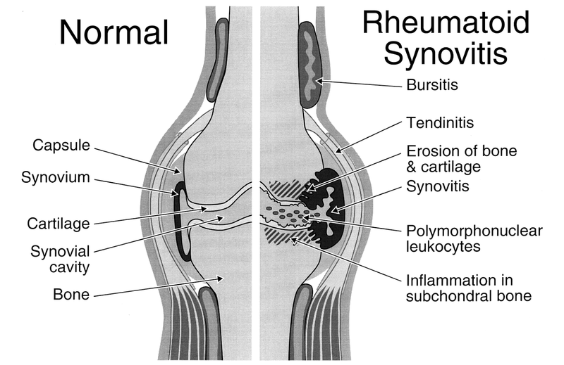 Synovial Tissue