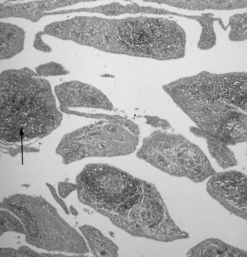 Synovial Tissue